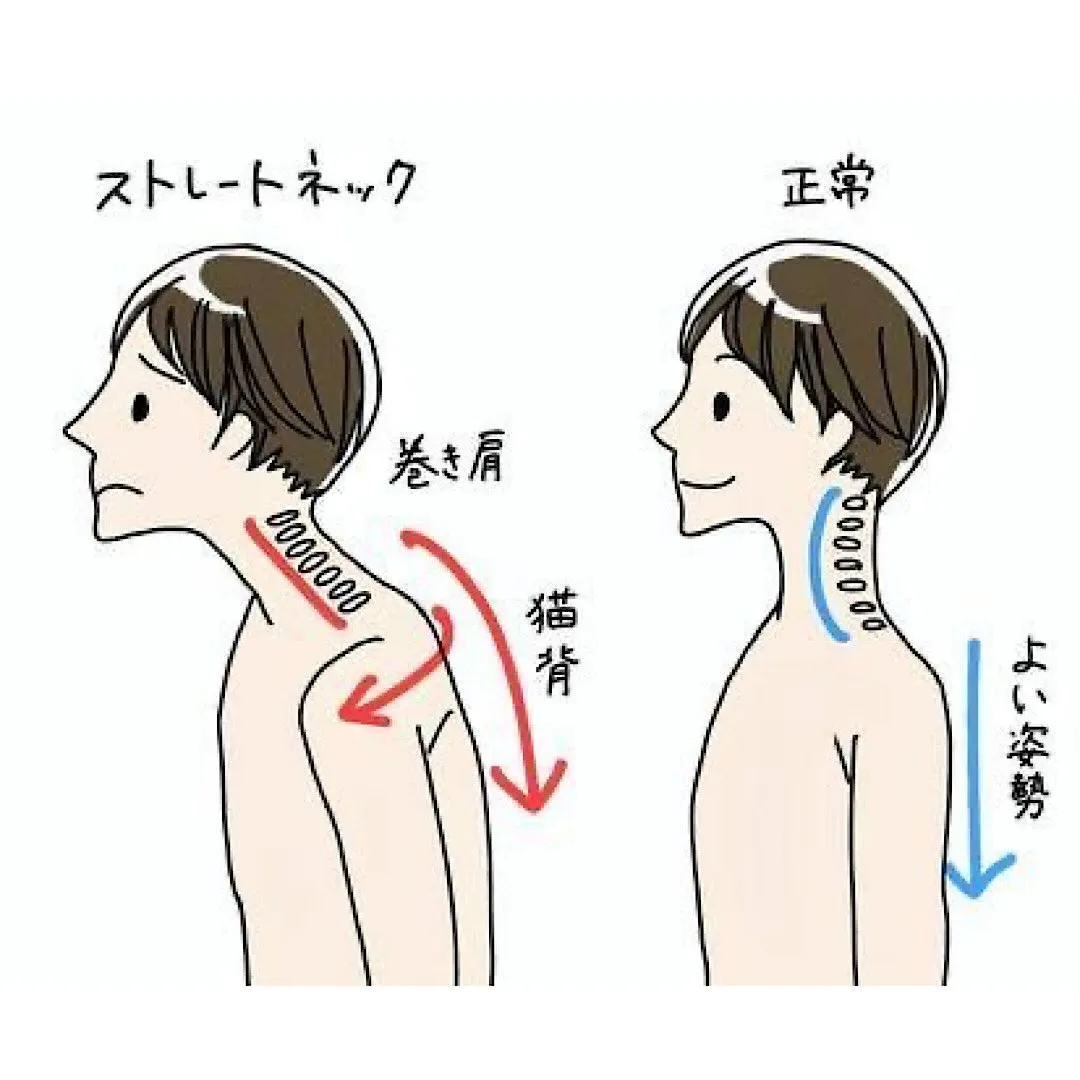 📱ご存知ですか？【ストレートネック】😖