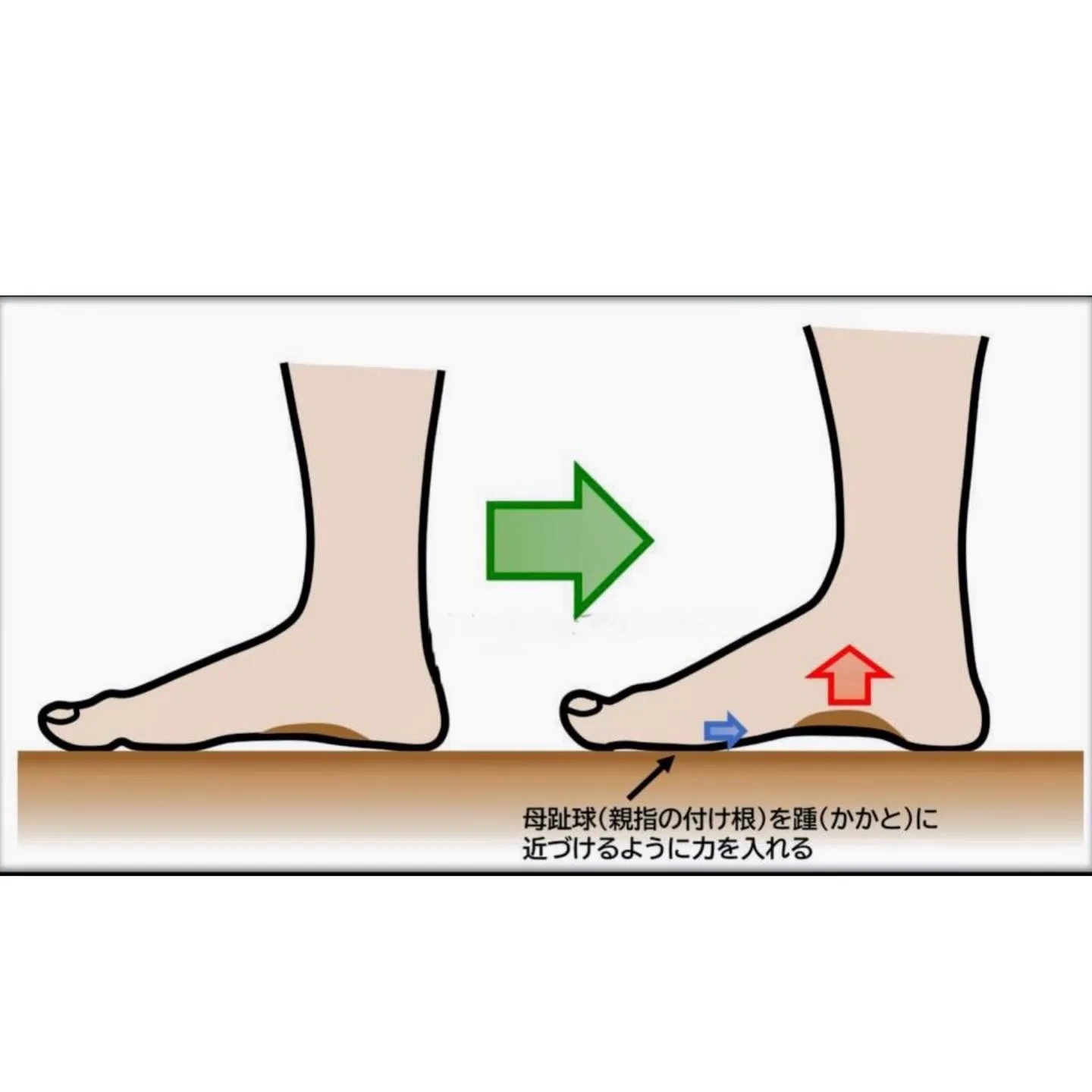 🦵扁平足は…😖